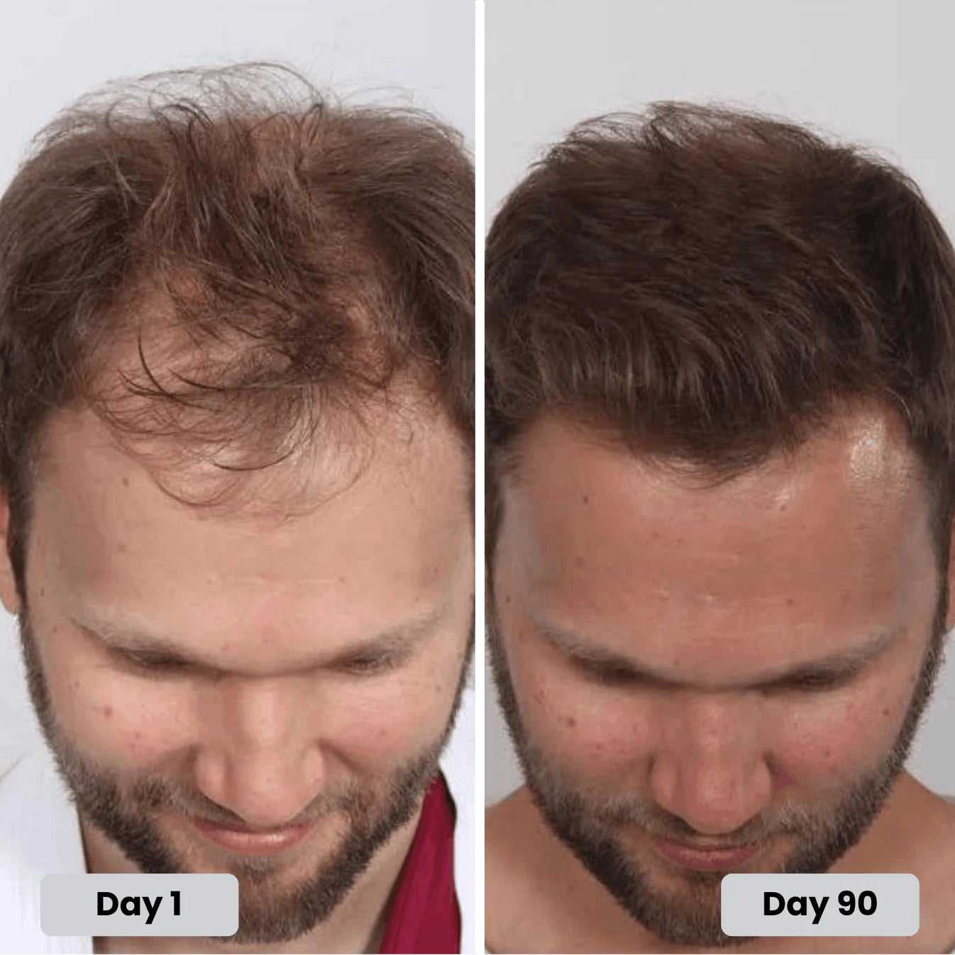 Customer Day 1 vs Day 90 crown regrowth