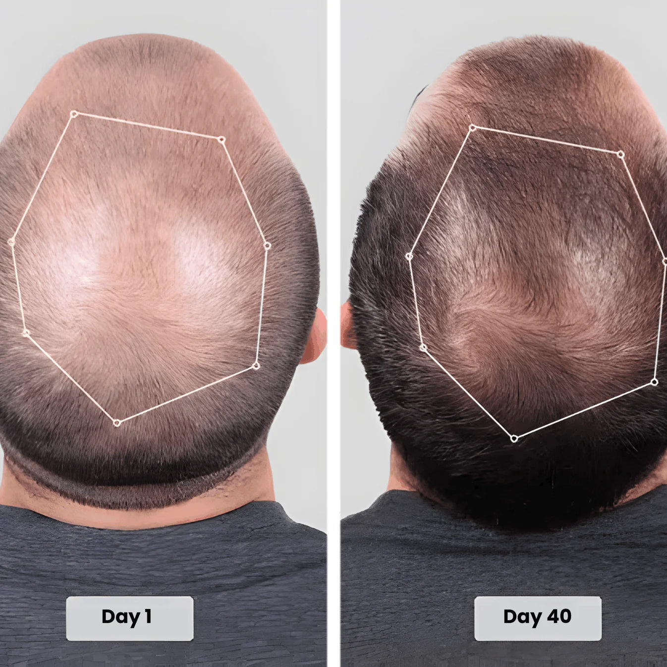 Customer Day 1 vs Day 40 early results